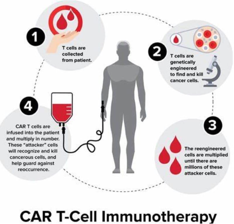 Car-T-Cell Therapy